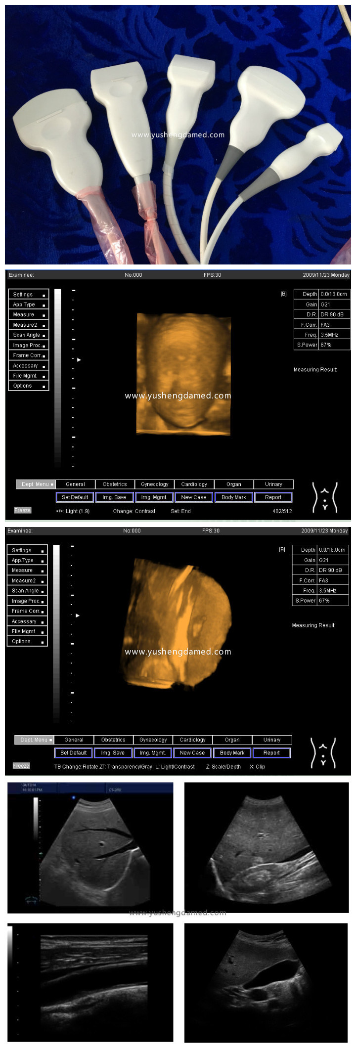 Ce Approved PC Based Medical System Digital Portable Ultrasound Scanner