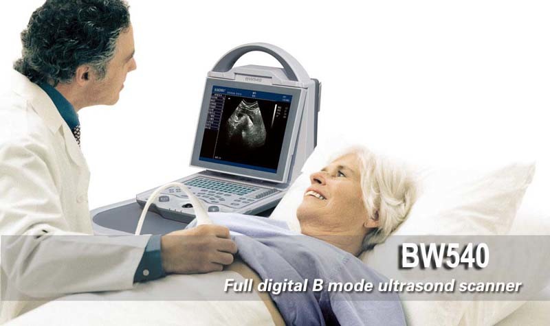 4D Ultrasound, What's The Price for 4D Ultrasound, Full Digital Portable Ultrasound (BW540)