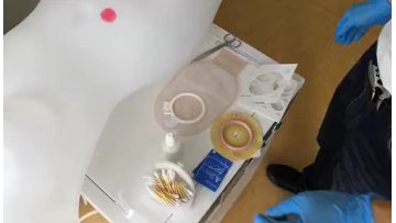 two pieces ostomy bag