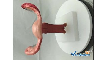 Uterus Model