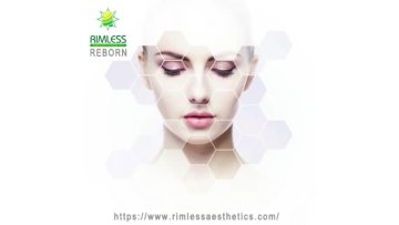 Reborn PLLA Dermal Filler Wrinkle Remove