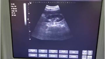 laptop ultrasounds video 3