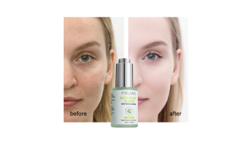 Glycyrrhiza glabra whitening serum