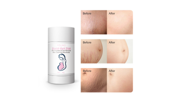 Melao Mom Care Stretch Mark Remover Stick Pregnancy Acne Cream Removal Helping Scars Prevention Stretch cream Stick1