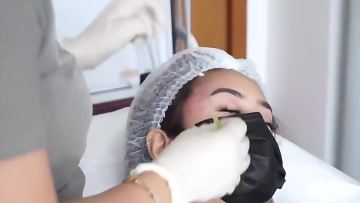 Hot selling tornado thread pdo mono thread lift 29g 25mm pdo screw thread lifting1