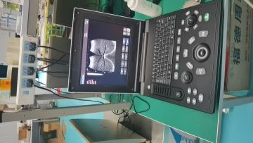 laptop ultrasounds video 6