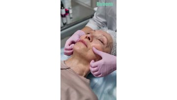 PLLA Dermal Filler For Face Lifting