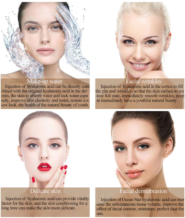 Hot Sale New Product Ocean Star 10ml Dermal Filler Ha Injectable Hyaluronic Acid for Anti Wrinkle supplier