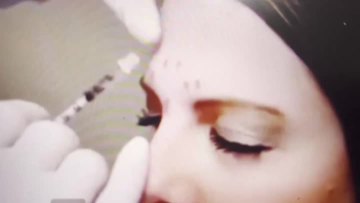 botox innotox