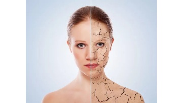 Working principle of plla dermal filler