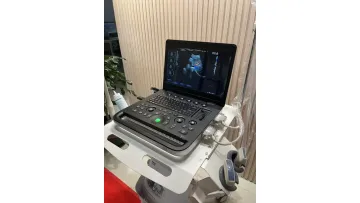 Portable 4D Ultrasound Machine Veterinary Instrument for Medical Diagnostic Imaging Centers Equipment for Sale1