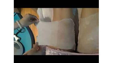 Cryolipolysis for fat removal