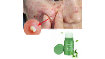 Green Tea Musk Mask Stick: Moisturizing and Deep Cleansing Clay Facial Purifying Stick for All Skin Types1
