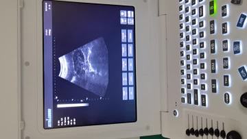 laptop ultrasounds video 2