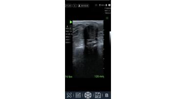equine ultrasound machines