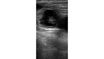 cattle ultrasound machine
