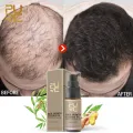 PURC Fast Hair Growth Oils Essence Health Hair Loss Treatment for Hair Growth Products Hair Care 20ml