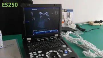 Veterinary Sonography, Diagnostic Ultrasonic Imaging System for Veterinary Use Es250V1