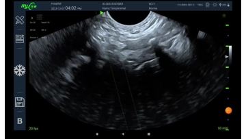 color ultrasound