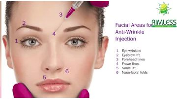 PLLA Dermal Filler for facial treatment