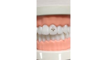 tooth gems
