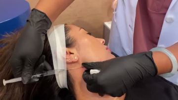 Obvious effective facial pdo threads arm lift series korean thread lift needleless thread lifting1