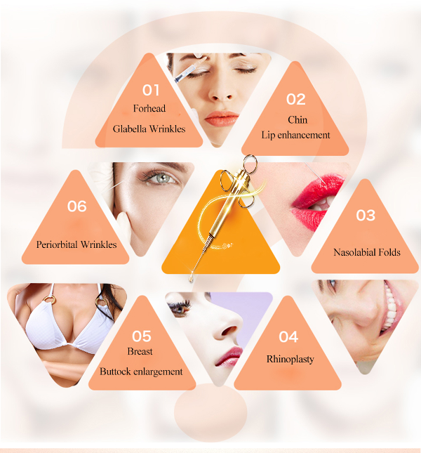 Hot Sale New Product Ocean Star 10ml Dermal Filler Ha Injectable Hyaluronic Acid for Anti Wrinkle supplier