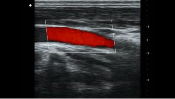 diagnostic ultrasound machine