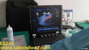 Veterinary Hospital Equipment, Es230V Veterinary Ultrasound Color Doppler Ultrasonic Diagnostic Imaging System,1