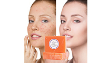 Hot Selling Handmade Kojic Acid Soap - Private Label Organic Skin Whitening Solution1