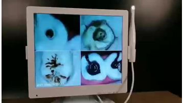 Factory Price Dental Equipment HD Quality Display Intraoral Oral Monitor Intraoral Camera1