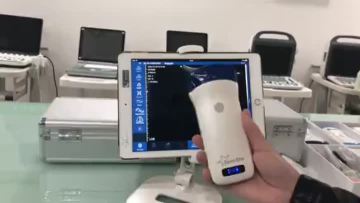 color convex probe.MP4