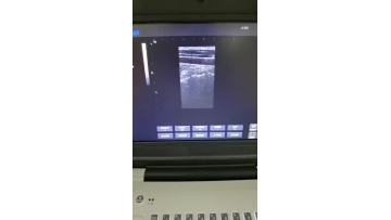 laptop ultrasounds video 5