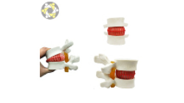Vertebral Spine Simulator for Lumbar Disc Herniation Medical Science Model1