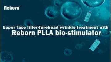 Naturally Bio-stimulator For Face Rejuvenation