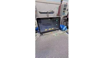 vital monitor