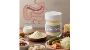 Lactobacillus reuteri