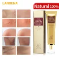 LANBENA Acne Scar Removal Face Cream Acne Spots Acne Pigmentation Corrector Anti Scar Stretch Marks Repair Skin Care 30G