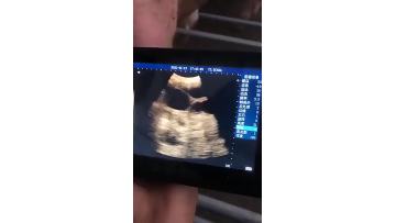 A8 ultrasound scanner