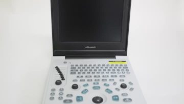 laptop ultrasounds video