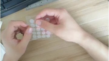 Acne patch
