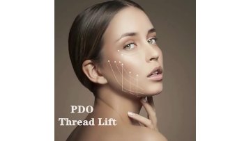 Shangyang pdo eye thread lift non surgical face ha pdo threads cog 4d thread for lifting double screw face and body1