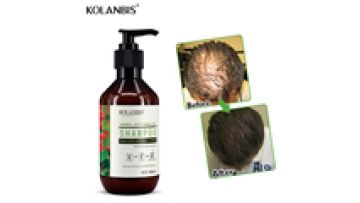 Best Organic Ginseng Hair Growth Medicated Shampoo 300ml1