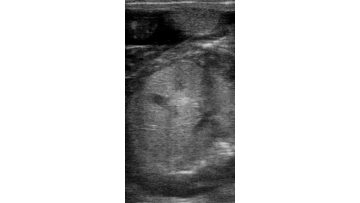 cow ultrasound machine