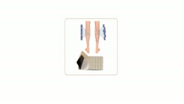 Varicose Veins Patch