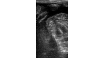 bovine ultrasound machine