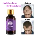 20ml Fast Hair Growth Faster Grow Hair Regrowth For Men Women Pure Natural Hair Loss Products Pilatory Treatment Anti-Hair Loss