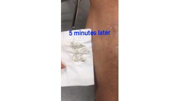 Hair removal cream