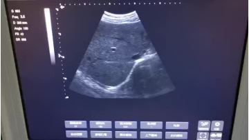 laptop ultrasounds video 4