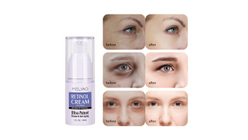 MELAO  Private Label Natural Remove Dark Circles Fade Fine Lines Anti Wrinkle Anti Aging Firming Retinol eye cream1